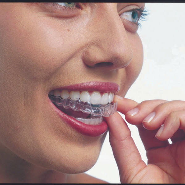 Foto 3 de Nielsen Ortodontia