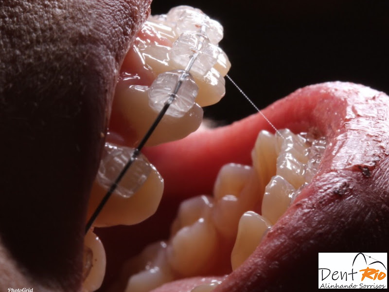 Foto 3 de Nilta Ana odontopediatra