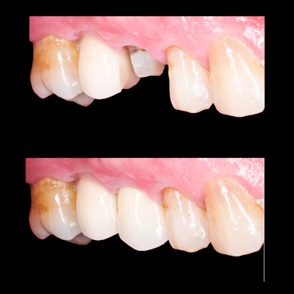 Foto 3 de Nitz Odontologia - Especialista em Implantes Dentários