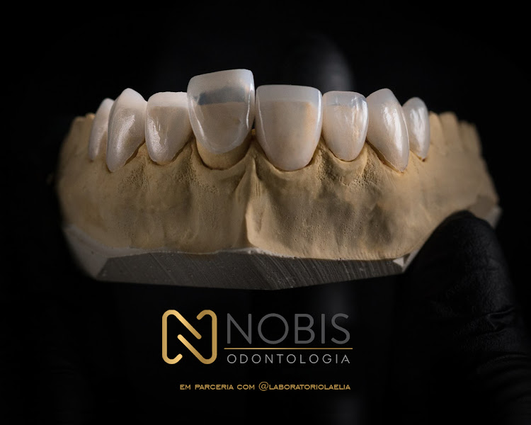 Foto 3 de Nobis Odontologia