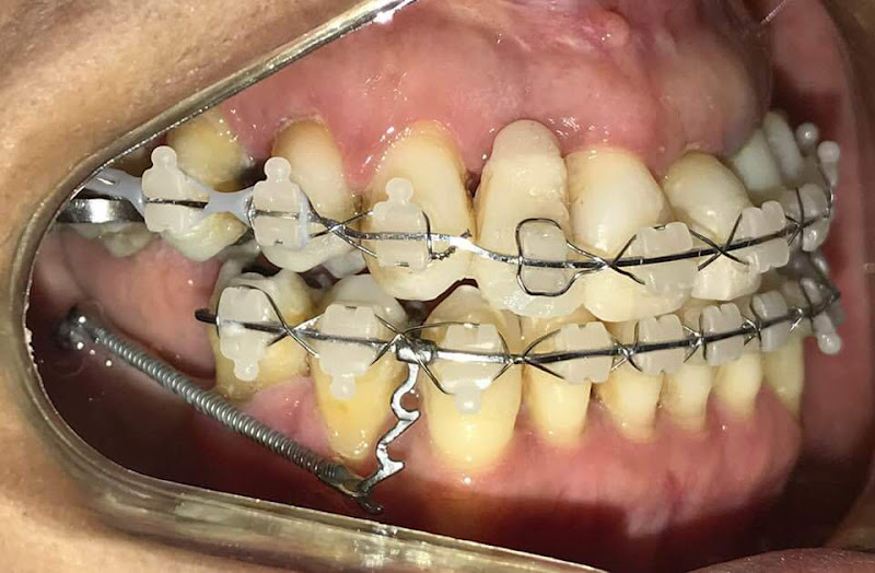 Foto 3 de Nogueira Odontologia Integrada