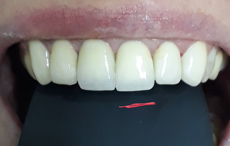 Foto 3 de Nopper Odontologia