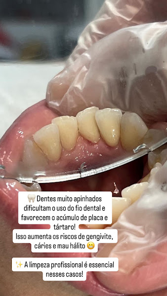 Foto 2 de NOSSO DENTE ODONTOLOGIA ESPECIALIZADA