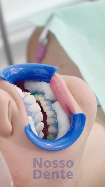 Foto 4 de NOSSO DENTE ODONTOLOGIA ESPECIALIZADA