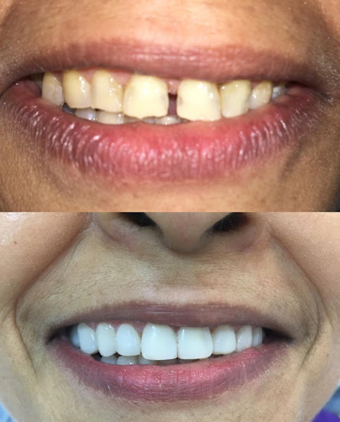 Foto 5 de NOSSO DENTE ODONTOLOGIA ESPECIALIZADA