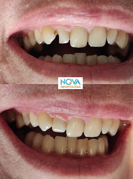 Foto 2 de Nova Odontologia