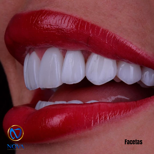 Foto 3 de Nova Odontologia São Braz