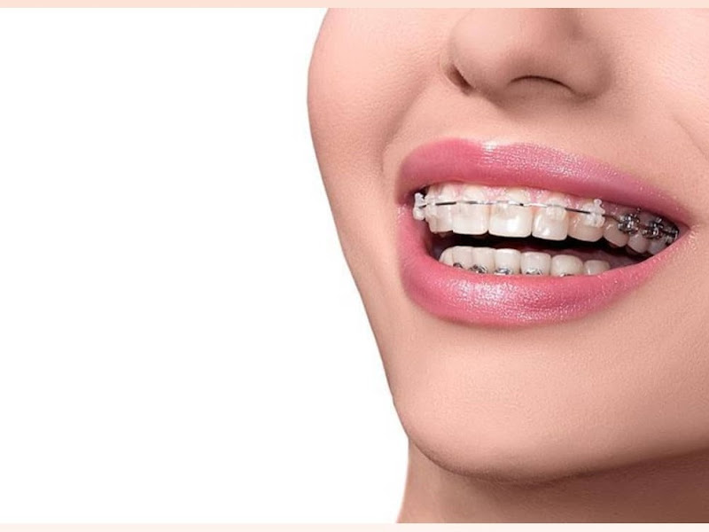 Foto 2 de nova ortodontia