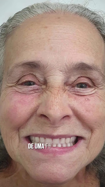 Foto 3 de Novadent | Dentista | Implante Dentário | Centro | São Gonçalo - RJ