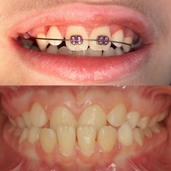 Foto 3 de Novadente Odontologia