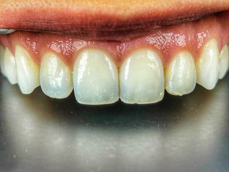 Foto 3 de NovaSorriso Odontologia - Drª Vanessa e Dr° Ricardo