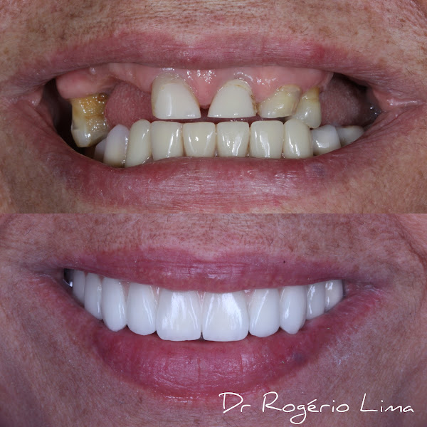 Foto 3 de Novo Mundo Odontologia Dr Rogério Guimarães Lima e equipe