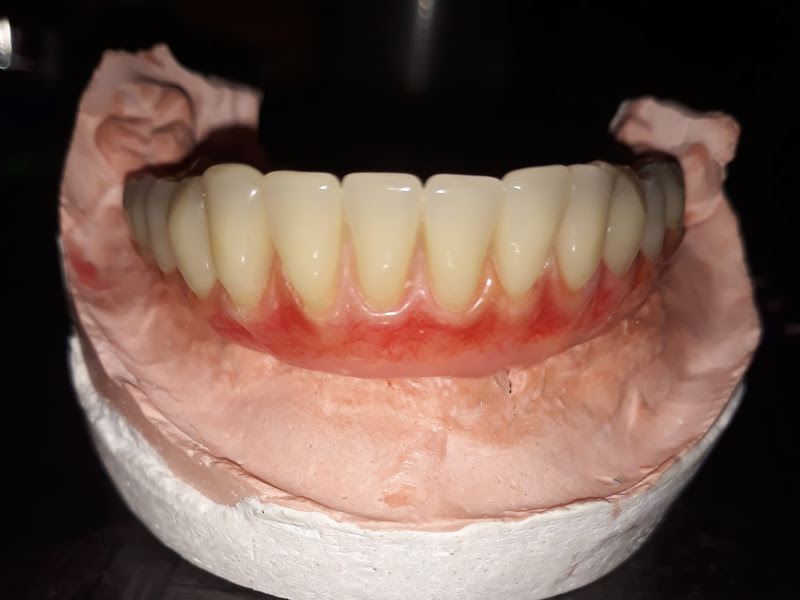 Foto 2 de novo sorriso