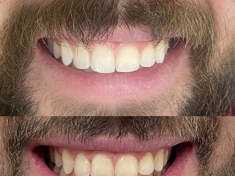 Foto 6 de novo sorriso