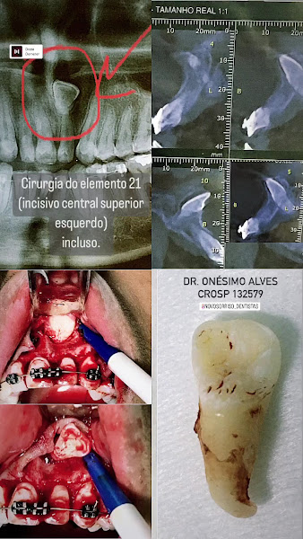 Foto 2 de Novo Sorriso Dentistas - Aparelho Fixo - Prótese - Cirurgia de siso