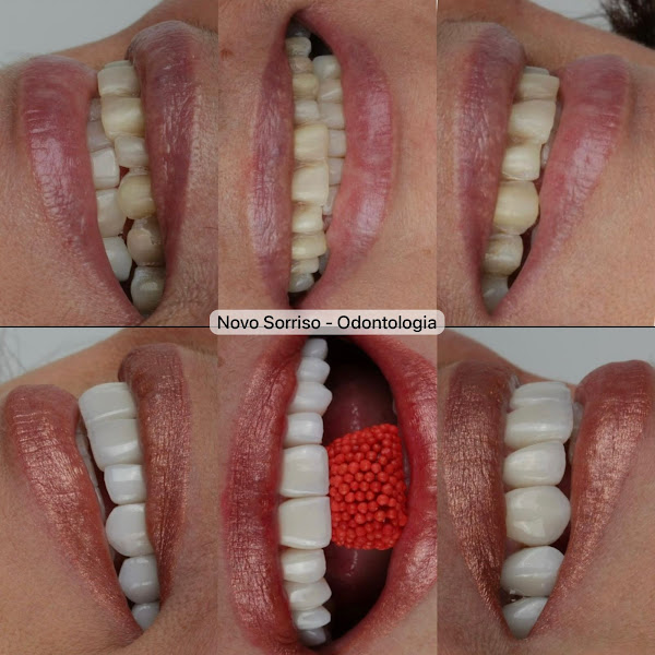 Foto 3 de Novo Sorriso - Odontologia