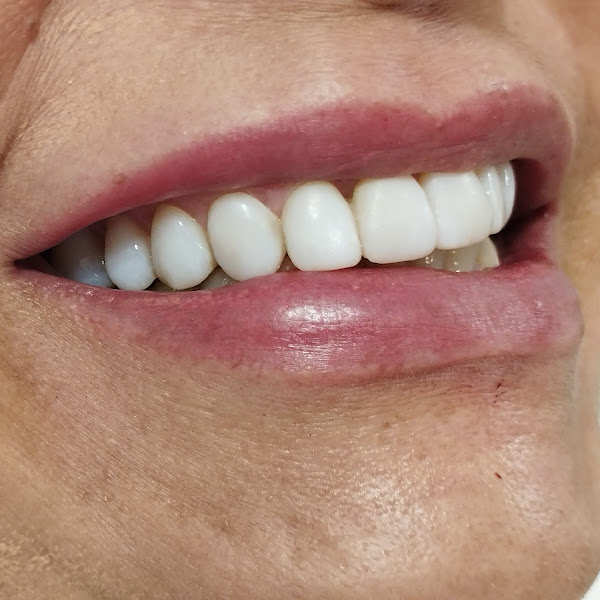 Foto 2 de NT Odontologia e estética orofacial