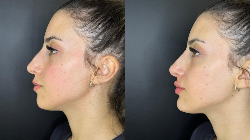 Foto 3 de Nubelle São José dos Pinhais | Harmonização e Estética