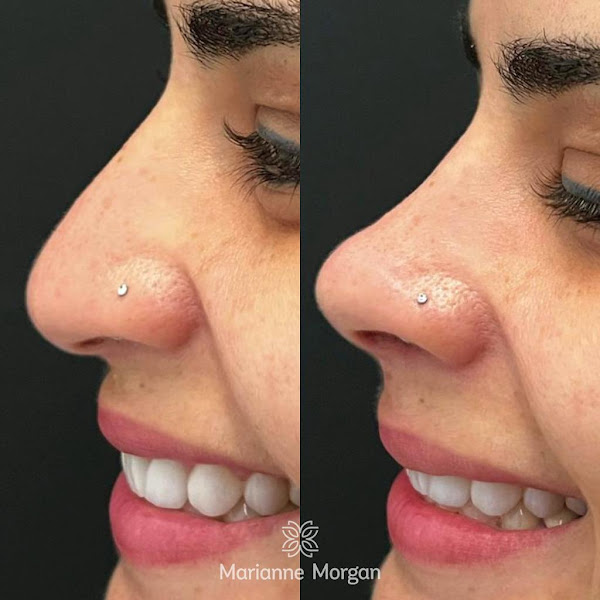 Foto 3 de Núcleo Marianne Morgan | Harmonização Facial em Aracaju