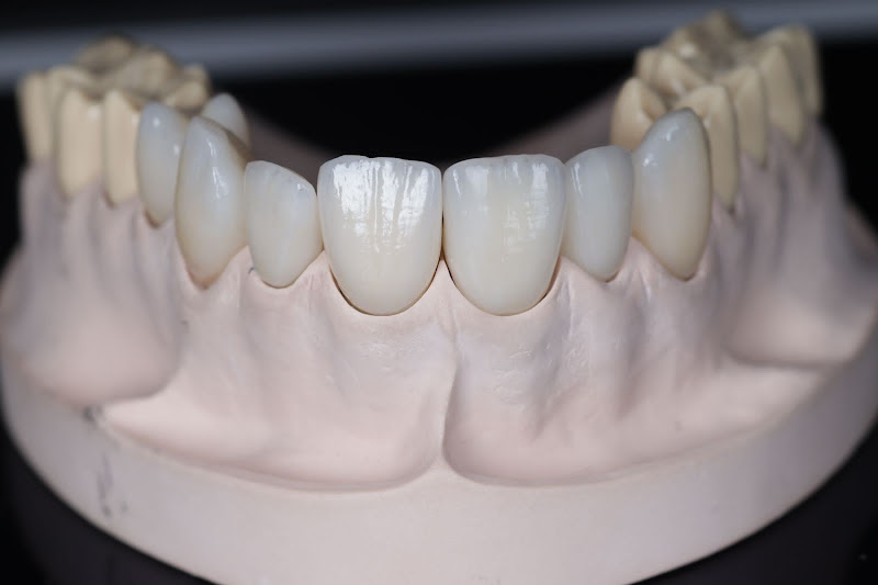 Foto 3 de Núcleo Odontológico Dr. Isac Fernandes