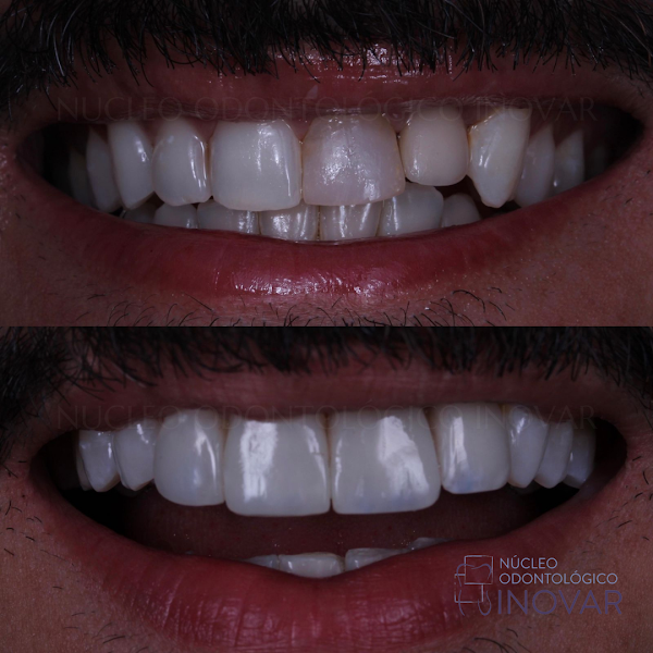 Foto 3 de Núcleo Odontológico Inovar