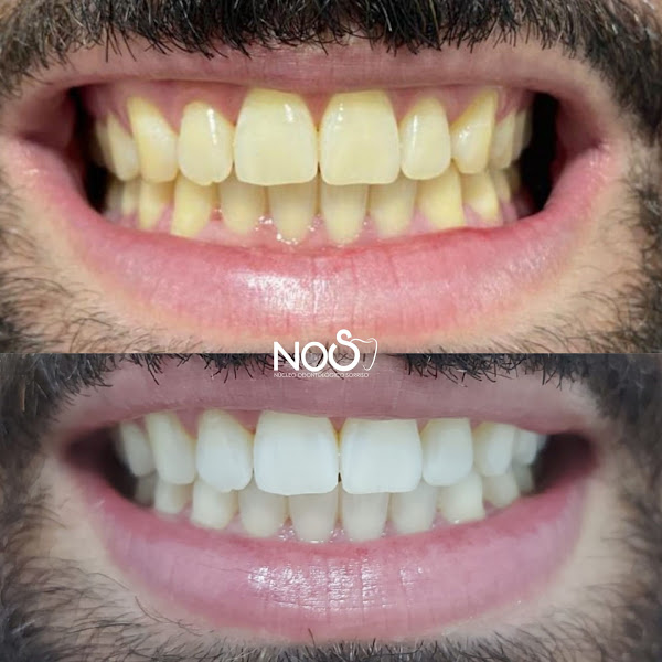 Foto 2 de Núcleo Odontológico Sorriso
