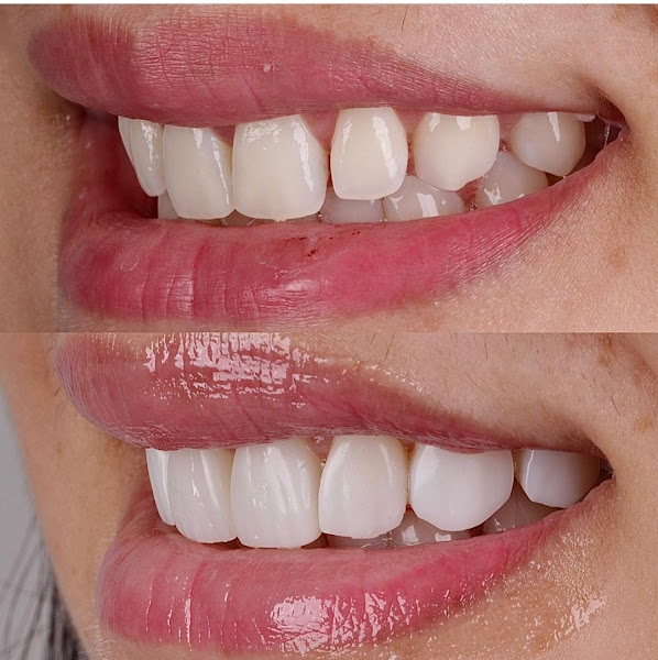 Foto 3 de Núcleo Odontológico Vila Cristina