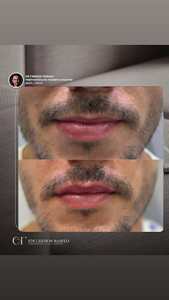Foto 3 de NutroMed | Clínica de Emagrecimento e Estética em Salvador