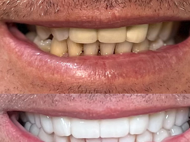 Foto 10 de Nuvance Odontologia