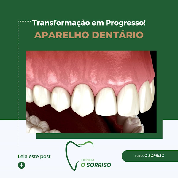 Foto 4 de O Sorriso - Clínica Odontológica