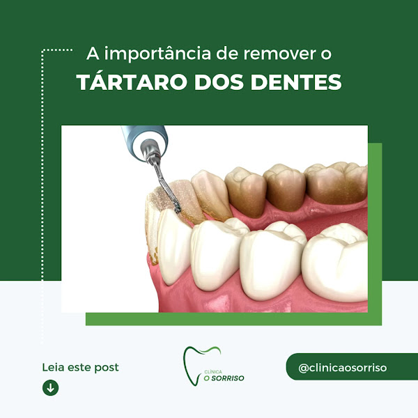 Foto 5 de O Sorriso - Clínica Odontológica