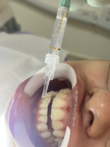 Foto 3 de OÁSIS ODONTOLOGIA HUMANIZADA | IMPLANTES DENTÁRIOS