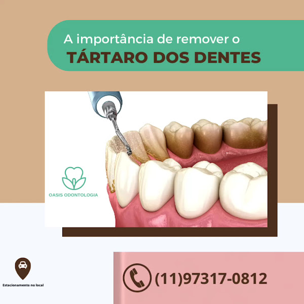 Foto 5 de OÁSIS ODONTOLOGIA HUMANIZADA | IMPLANTES DENTÁRIOS