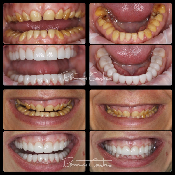 Foto 5 de Obno Odontologia - Implantes Dentários em Montes Claros