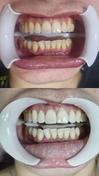 Foto 3 de Oclusão Odontologia