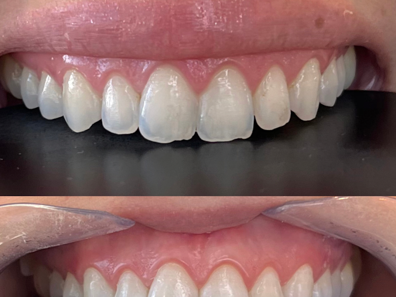 Foto 2 de OD - Odontologia Estética e Harmonização Facial