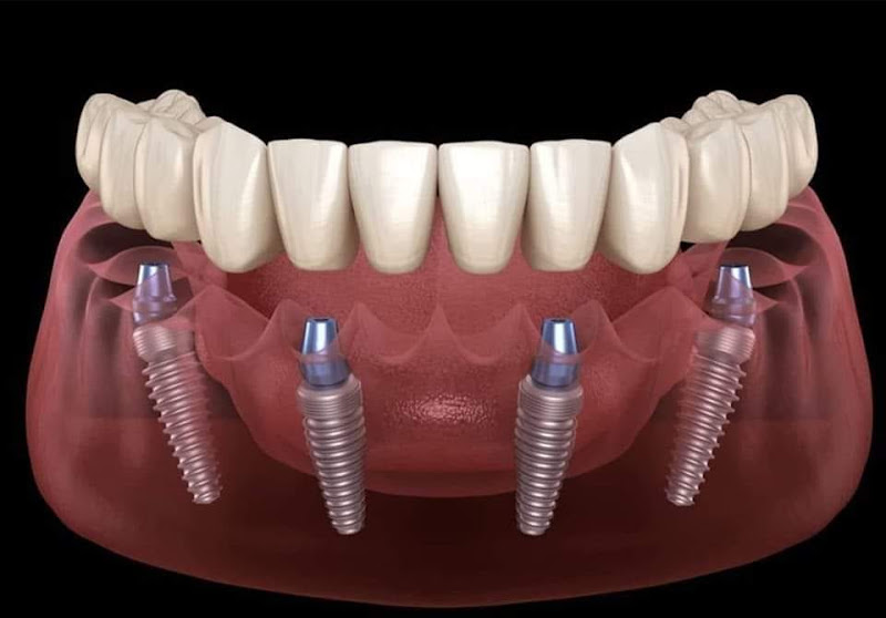 Foto 3 de ODONT- Odontologia Especializada Ltda