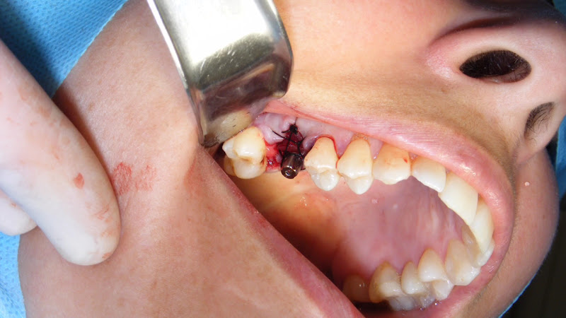 Foto 3 de ODONTHIA ODONTOLOGIA