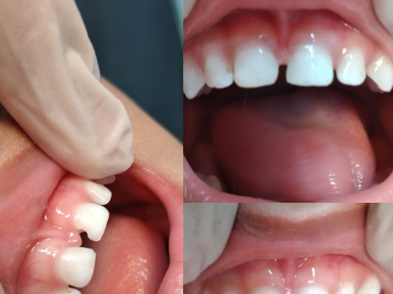 Foto 7 de Odontix Kids Duque de Caxias - Dentista Infantil (Odontopediatria)