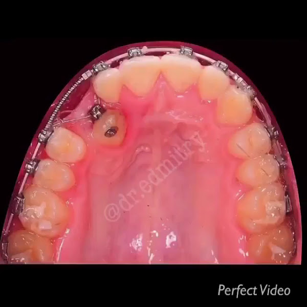 Foto 3 de Odonto Acre - Clínica Odontológica