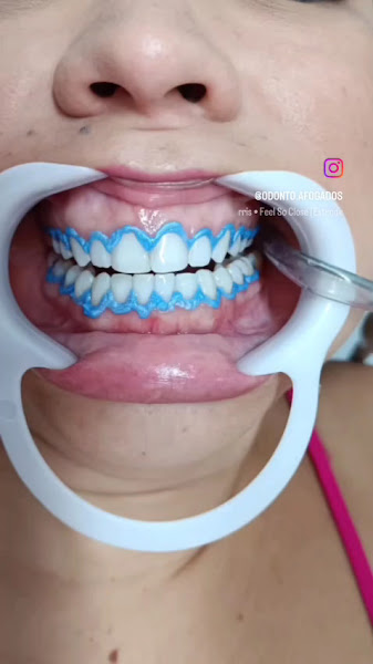 Foto 4 de ODONTO AFOGADOS