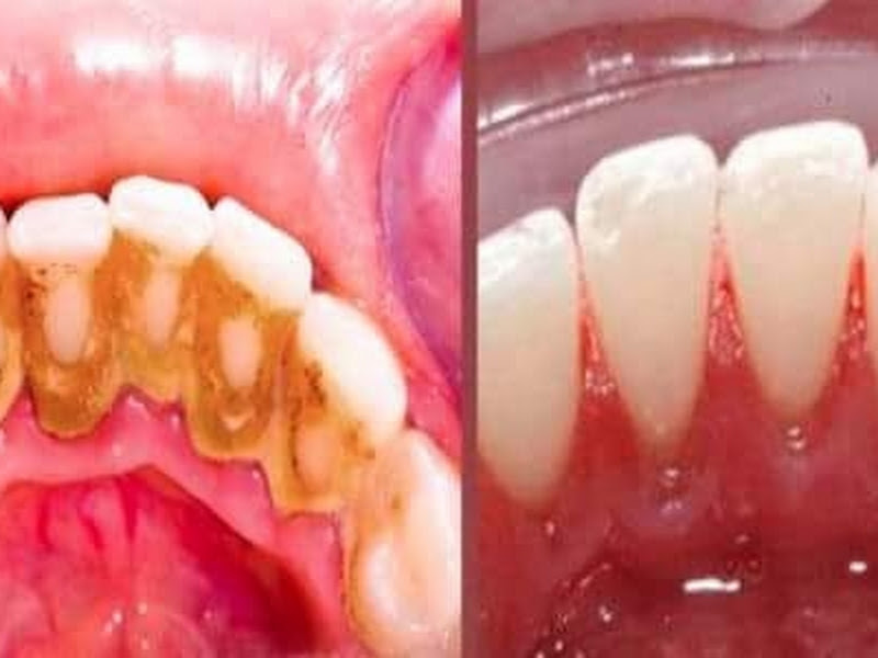 Foto 7 de Odonto Araújo