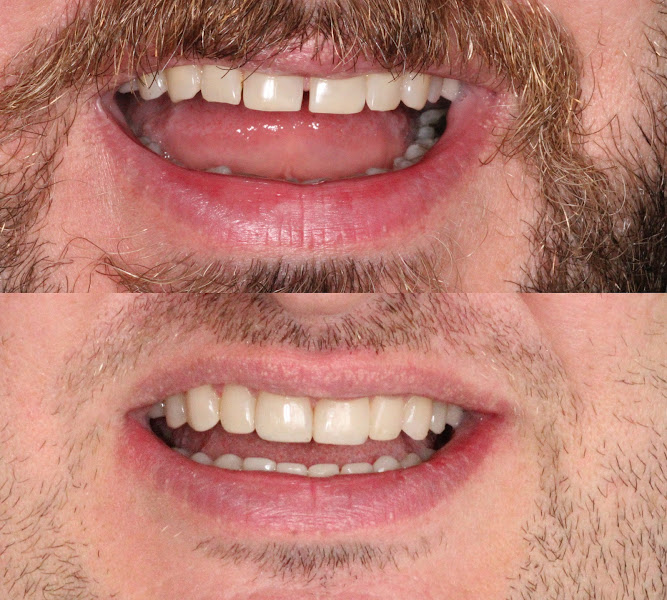 Foto 2 de Odonto Bela Vista - Dra. Tassia Freitas