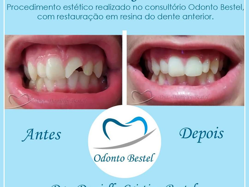 Foto 3 de Odonto Bestel