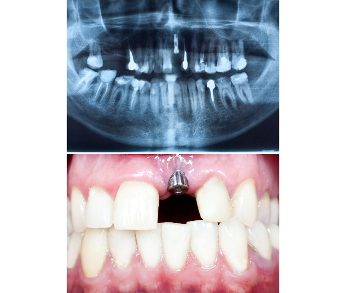 Foto 3 de Odonto Bittencourt Implante Dentário Ramos