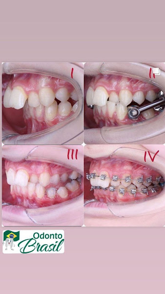 Foto 3 de Odonto Brasil - Clínica Odontológica - Vitória da Conquista