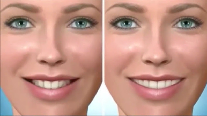 Foto 3 de Odonto Brasil Taubaté Diego Neves e Hirid Brasil