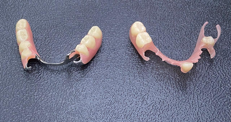 Foto 3 de Odonto Bright ParkShopping | Implantes Dentários | Dentista em Campo Grande Rio de Janeiro