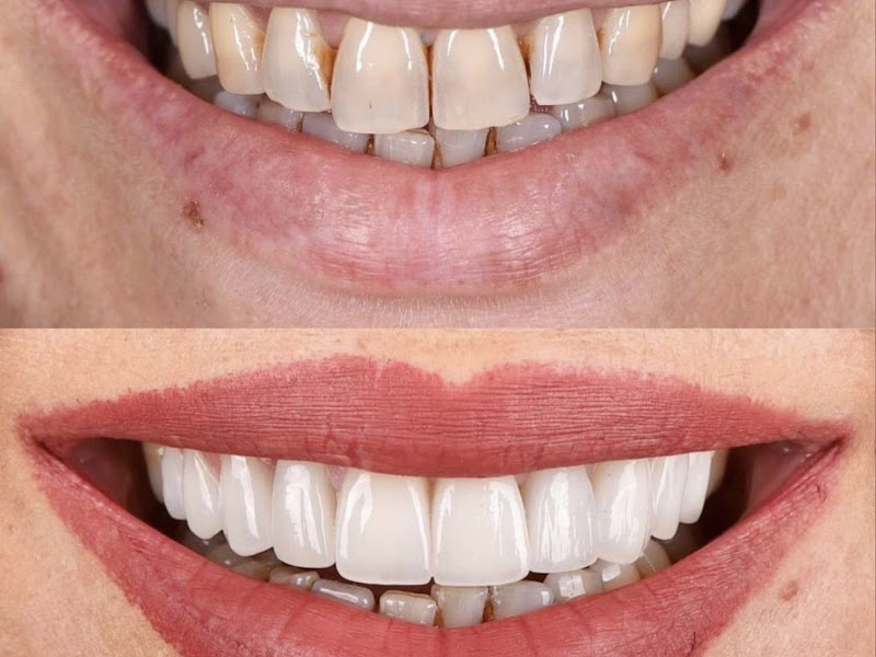 Foto 3 de Odonto Calm