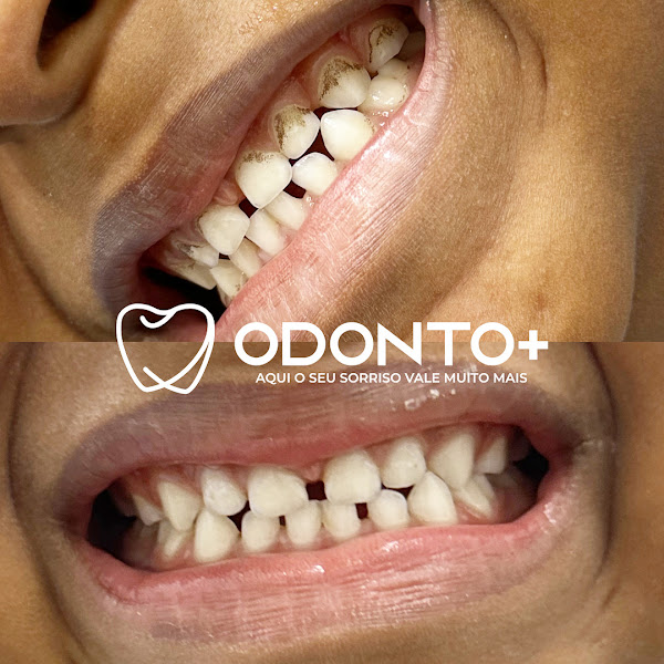 Foto 2 de Odonto+ Candeias | Consultório Odontológico